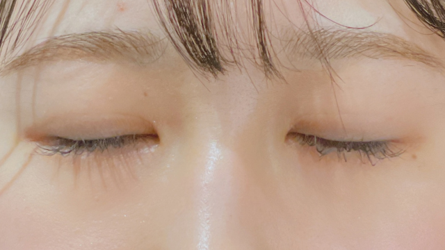 手术前的状态 其一