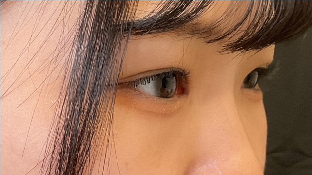 Postoperative Condition Part 1