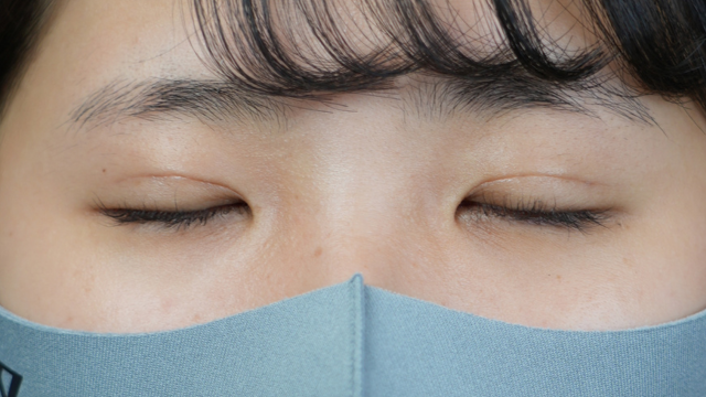 手术前的状态 其一