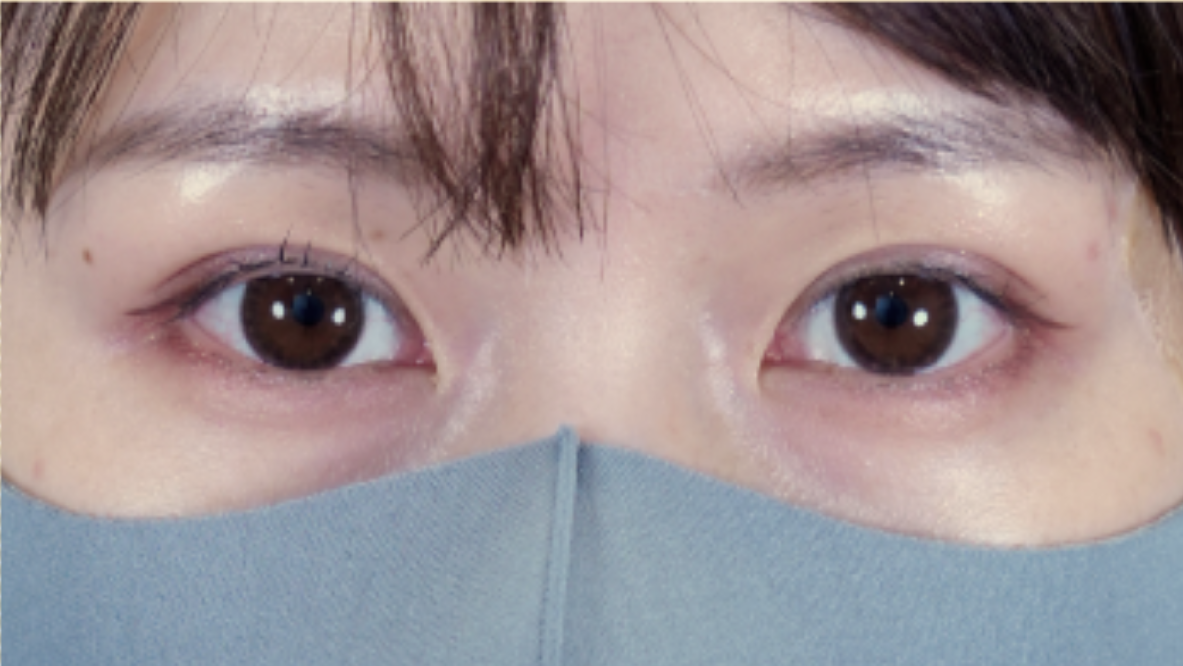 手术前的状态 其一