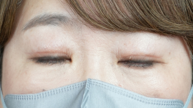 Postoperative Condition Part 1