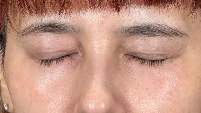 手术前的状态 其一