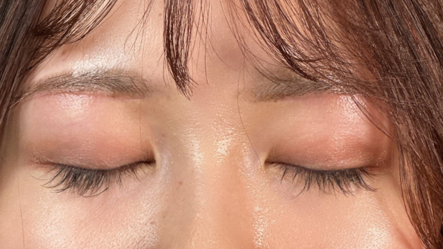 Postoperative Condition Part 1