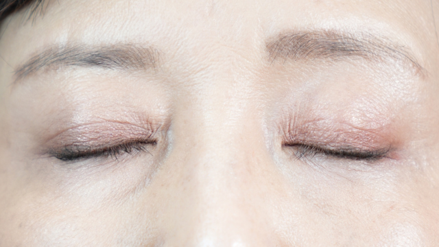 手術前の状態 その1