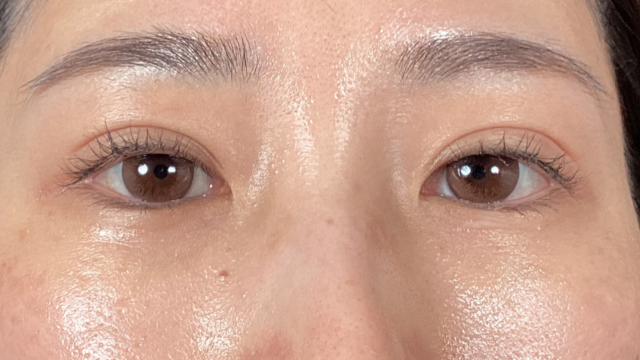 手术前的状态 其一