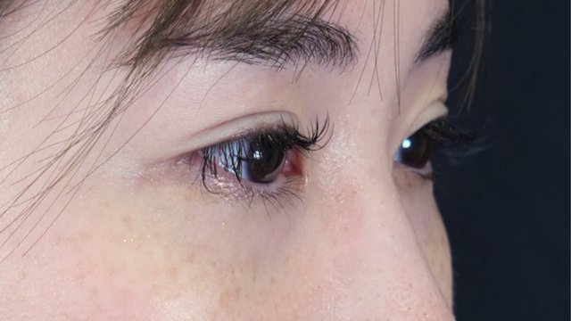 手術前の状態 その1