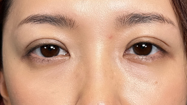 手术前的状态 其一