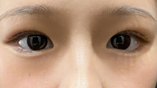 手术前的状态 其一