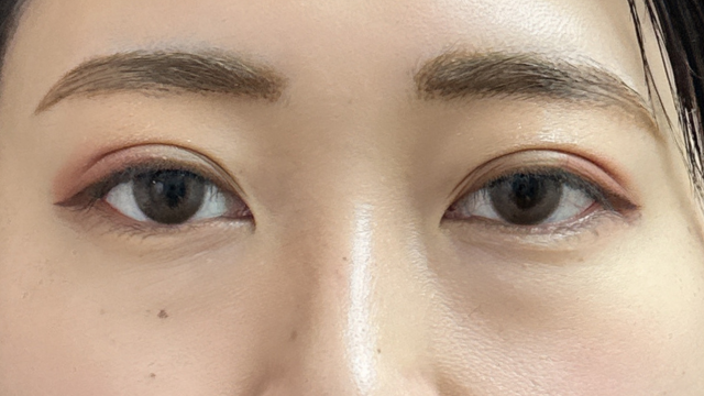 手术前的状态 其一