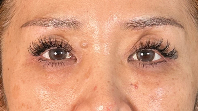 Postoperative Condition Part 1