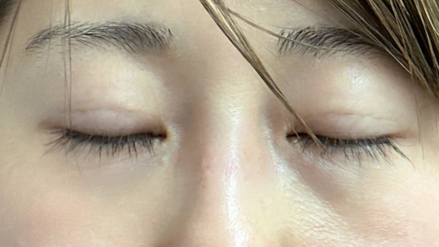 手术前的状态 其一