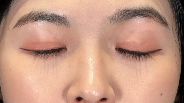 手术前的状态 其一