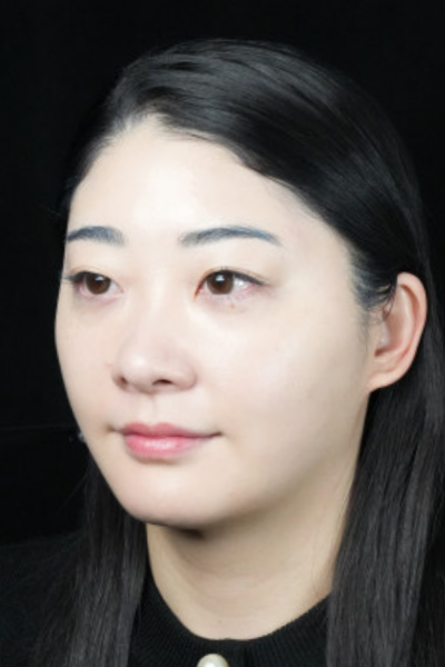 手术前的状态 其一