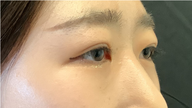 Postoperative Condition Part 1