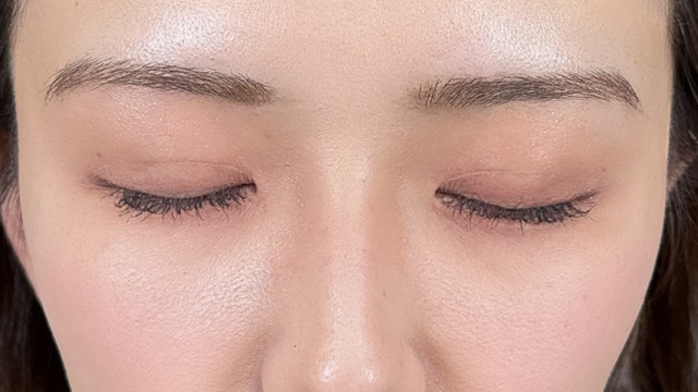 手术前的状态 其一