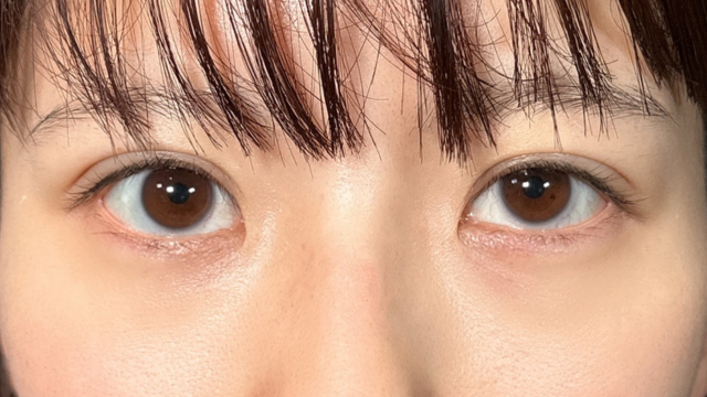 手术前的状态 其一