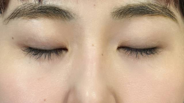 手术前的状态 其一