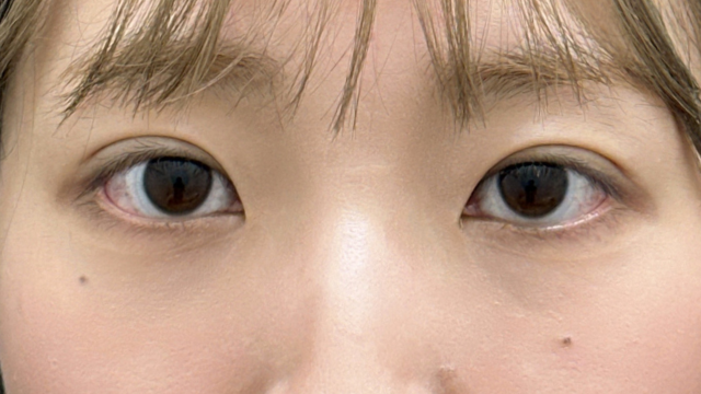 手术前的状态 其一