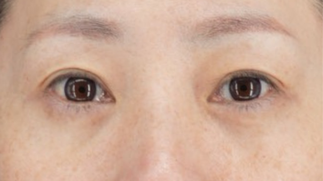 手术前的状态 其一