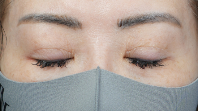 Postoperative Condition Part 1