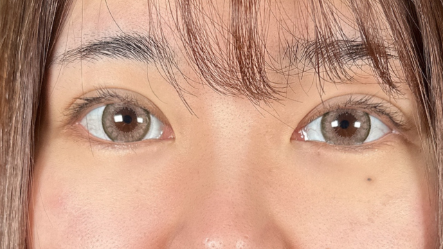 手术前的状态 其一