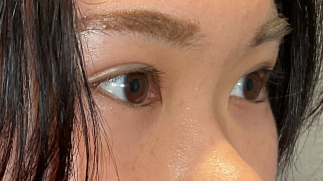 手术前的状态 其一