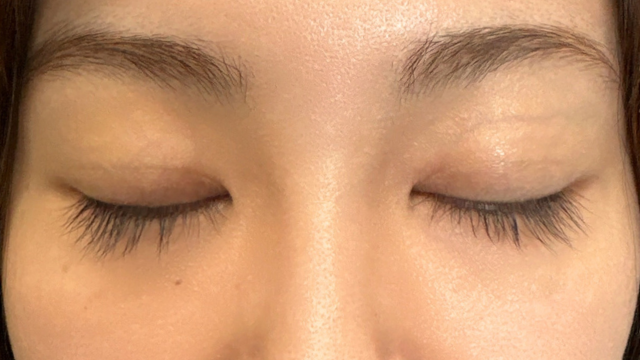 手术前的状态 其一