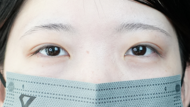 手术前的状态 其一