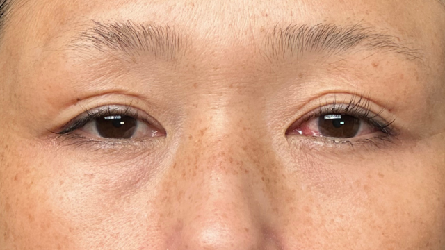 Postoperative Condition Part 1