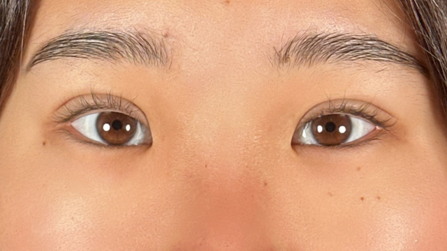 手术前的状态 其一