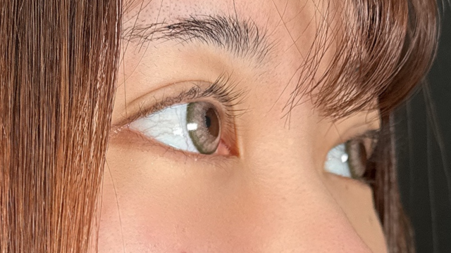 手术前的状态 其一