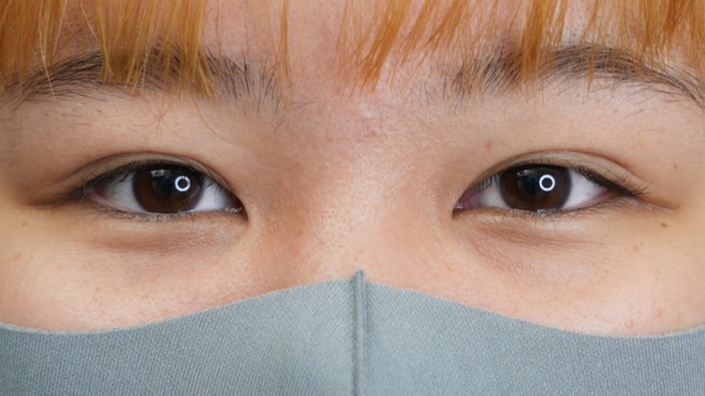 手术前的状态 其一