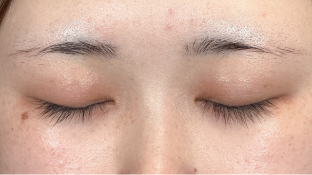 手術前の状態 その1