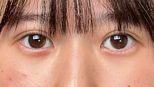 手术前的状态 其一