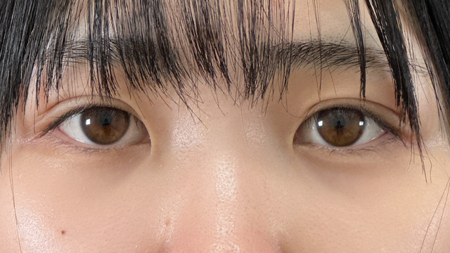 Postoperative Condition Part 1