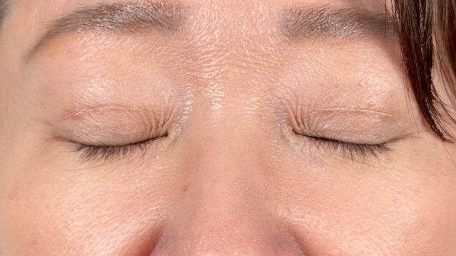 手術前の状態 その1