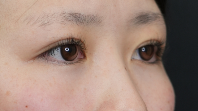 手术前的状态 其一