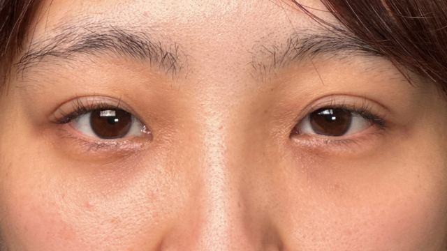 Postoperative Condition Part 1