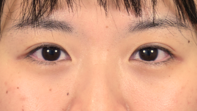 Postoperative Condition Part 1