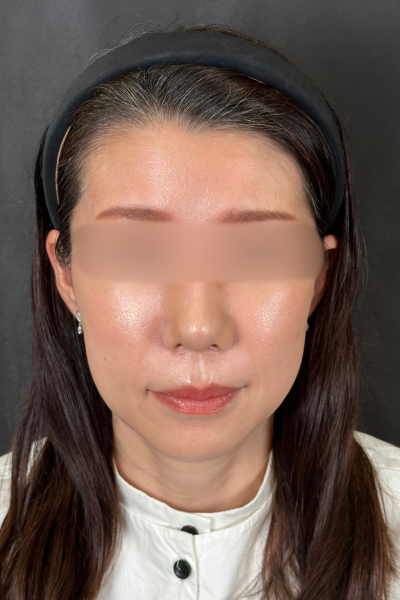 Postoperative Condition Part 1