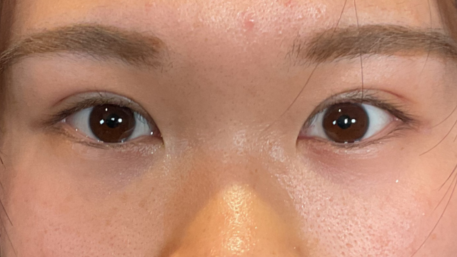 手术前的状态 其一