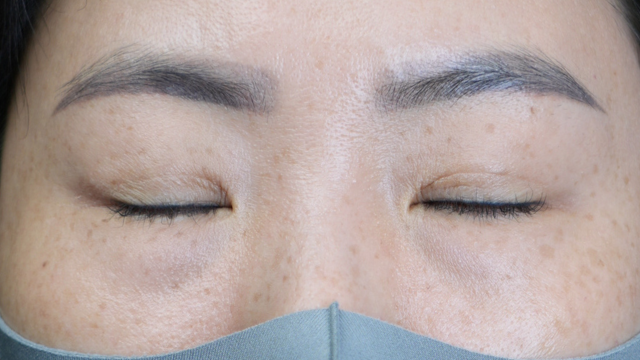 Postoperative Condition Part 1