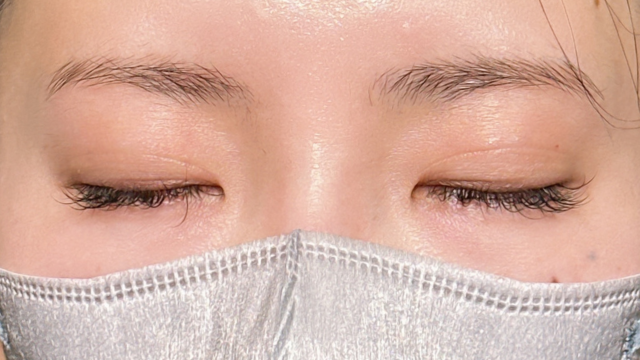 手术前的状态 其一