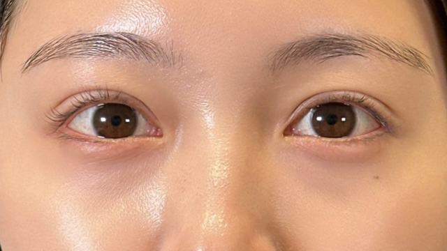 手术前的状态 其一