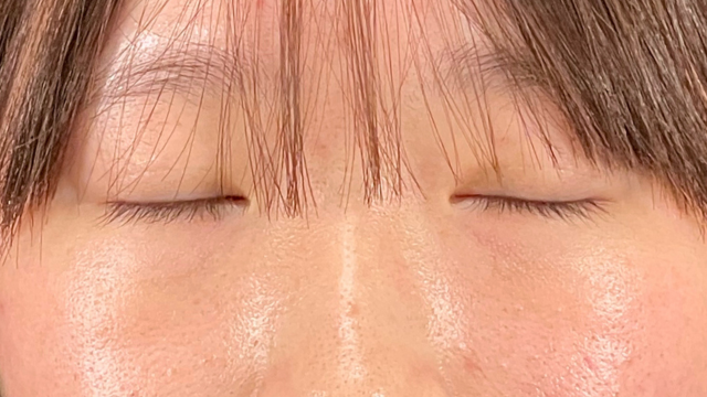 Postoperative Condition Part 1