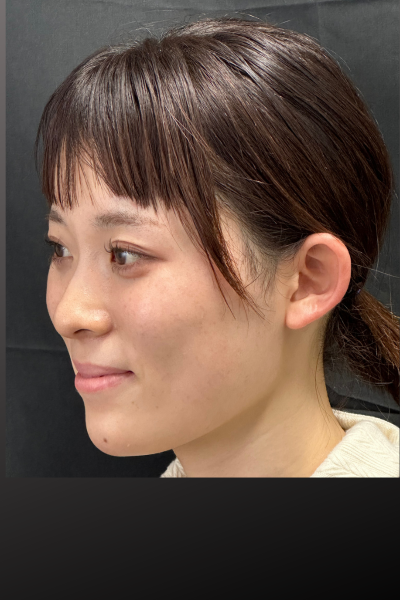 手術前の状態 その1