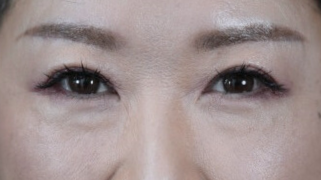 Postoperative Condition Part 1