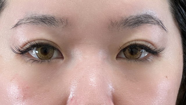 Postoperative Condition Part 1