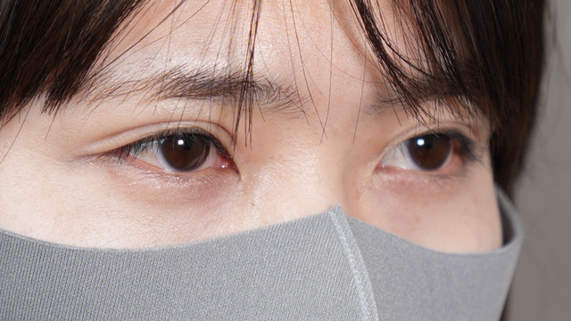 手术前的状态 其一