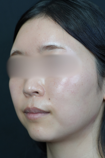 Postoperative Condition Part 1